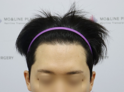 치료후기 이미지